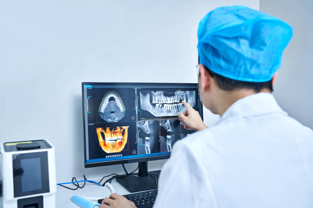 Best Emergency Wisdom Teeth Removal in Glendale, OH